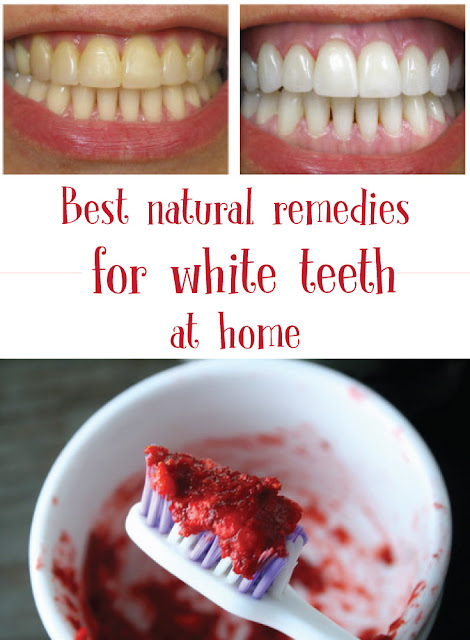 Best natural remedies for white teeth at home