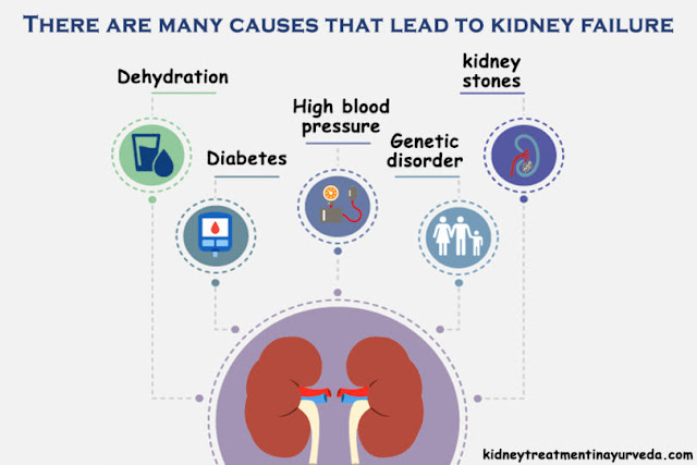 Ayurvedic Doctors for Kidney Failure Treatment in New Delhi, India