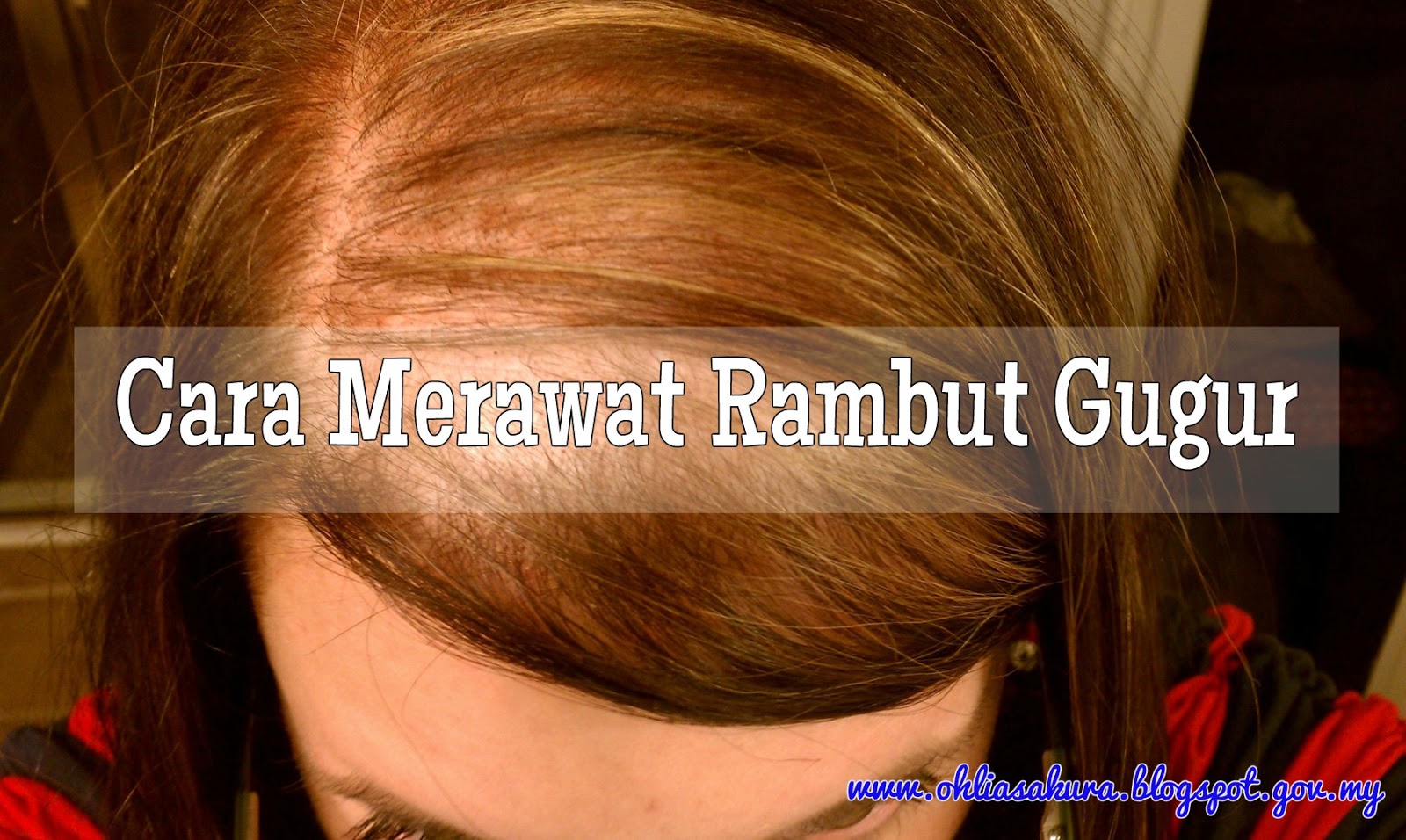 Blog Lia Cara Merawat Rambut Gugur