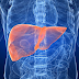 What Causes Fatty Liver ?
