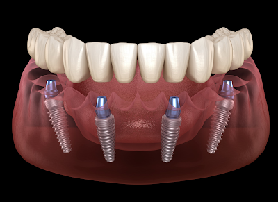 https://www.nextsmile.com.au/melbourne/