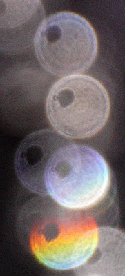 breast-like shape in orb