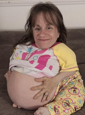 Unbeliveable - World's Smallest Women Is Pregnant