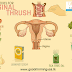 Home Remedies for Vaginal Thrush 