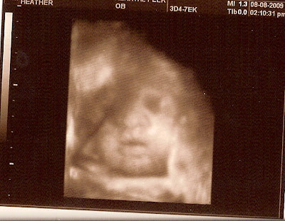 3d ultrasound pictures at 12 weeks. 4d Ultrasound 11 Weeks