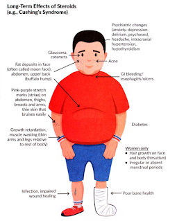 Cushing Syndrome