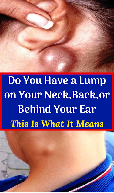 What It Means If You Have a Lump on Your Neck, Back, or Behind Your Ear