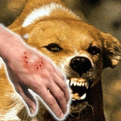 Ambon, Malukupost.com - Kasus rabies di Kota Ambon, Maluku, pada periode Januari hingga minggu pertama Februari 2019 terdapat 101 kasus dan 75 kasus di antaranya telah diberikan suntikan VAR dan satu orang warga meninggal dunia. Kepala Dinas Kesehatan Kota Ambon, Wendy Pelupessy di Ambon, Senin (11/2) mengatakan, kasus rabies yang mengakibatkan satu orang warga meninggal dunia itu, pihaknya telah melakukan pelacakan terhadap kasus gigitan lainnya.