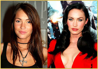 megan fox plastic surgery before and after