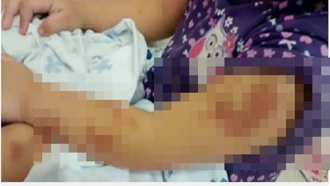 EMBRIAGADA: Mulher é presa por espancar frequentemente a própria filha de 4 anos