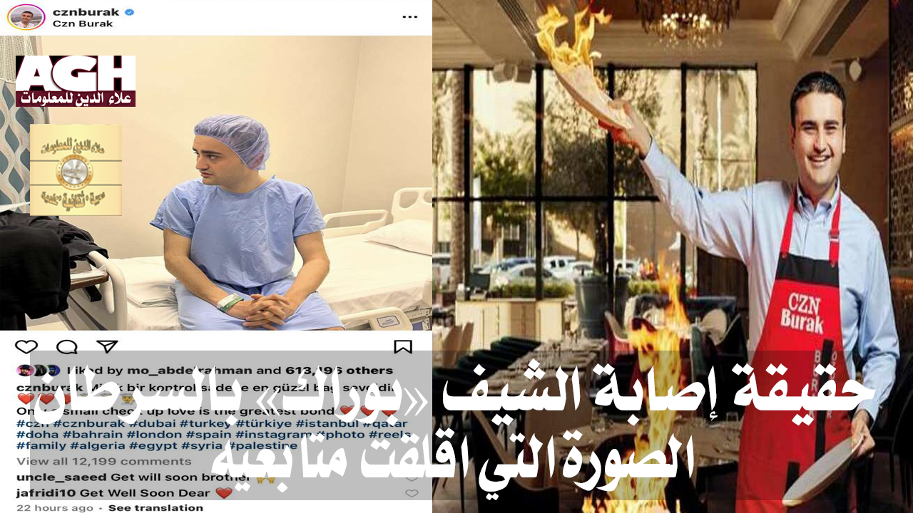 حقيقة إصابة الشيف «بوراك» بالسرطان.. صورة أثارت قلق متابعيه
