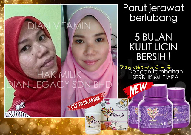 Testimoni Dianz Vitamin Extra Pearl