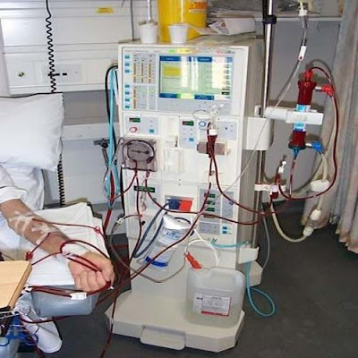 kidney dialysis equipment