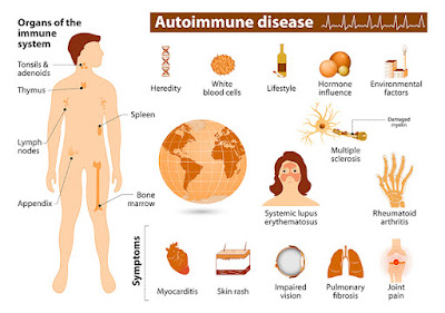 https://www.niehs.nih.gov/health/topics/conditions/autoimmune/index.cfm