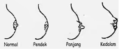 Maharena Blog makalah anatomi fisiologi payudara 