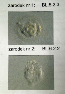 Zarodki transferowane w klinice Invicta