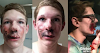 Oops: E-Cigarette explodes in teen’s his face while smoking [PHOTO]