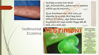 Testimoni Eczema pulih