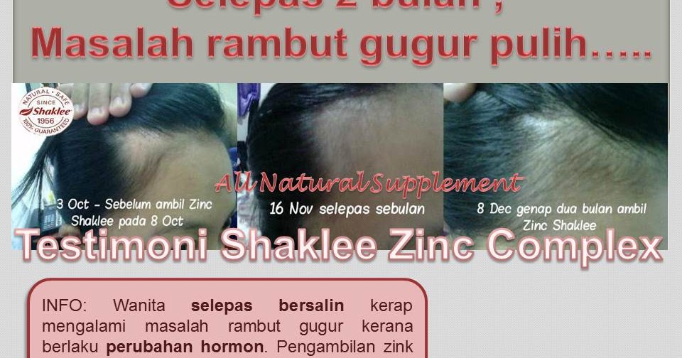 Dunia Vitaminku Masalah  rambut  gugur pulih dengan Zinc 