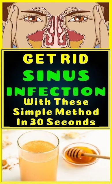 Get Rid Of Sinus Infection In 30 Seconds & This Simple Method & This Common Household Ingredient!!!