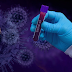 Boletim epidemiológico: Paraíba registra 34 novas mortes por covid-19 e 1.156 novos casos da doença nas últimas 24h