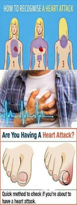 Could you have a heart attack and not know it?