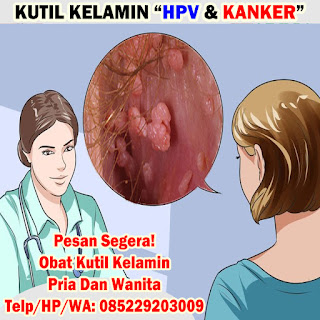 Obat Kutil Kelamin