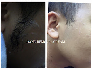 Nano Removal Hair Cream Murah - Tanggalkan Bulu - Cabut Bulu