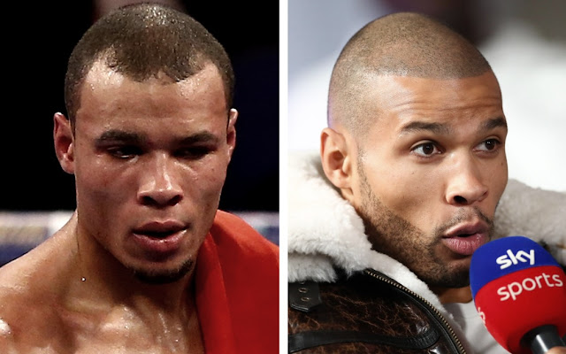 Chris Eubank Jr SMP hair loss