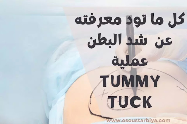 كل ما تود معرفته عن  شد البطن عملية tummy tuck