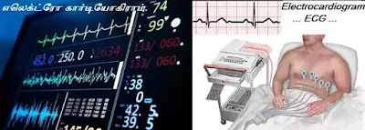 electrocardiogram - ECG