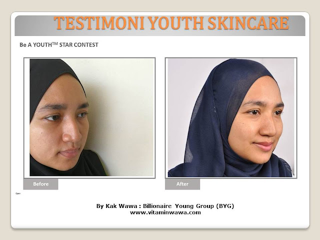 34 Testimoni Youth Skincare Shaklee Terbaru, Youth skincare shaklee, testimoni youth skincare shaklee, Youth Skincare Shaklee : Harga dan Review Pengguna Youth Shaklee, testimoni youth skincare shaklee, testimoni youth skincare shaklee