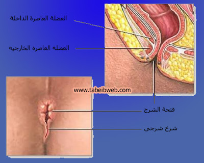 تعرف على الشرخ الشرجى بالصور الحقيقية