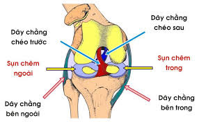 Hậu quả chấn thương dây chằng chéo trước đầu gối