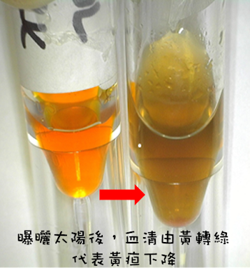 血清曬了太陽會變色