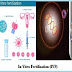 In Vitro Fertilization: A Comprehensive Guide to IVF