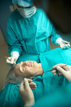 Blepharoplasty Surgery