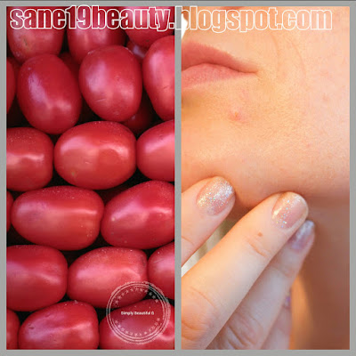 Tomatoes are beneficial for problematic skin.