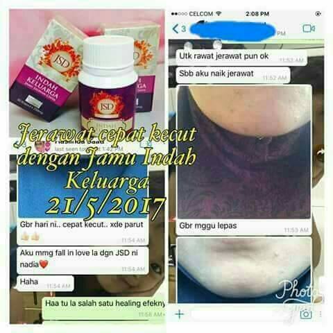 Testimoni Ubat Sakit Tekak - Pertanyaan x