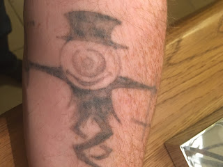 Tattoo fading after four q-switched and one picosure session