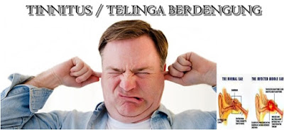 Tips Cara Mengobati Telinga Berdengung Tinnitus