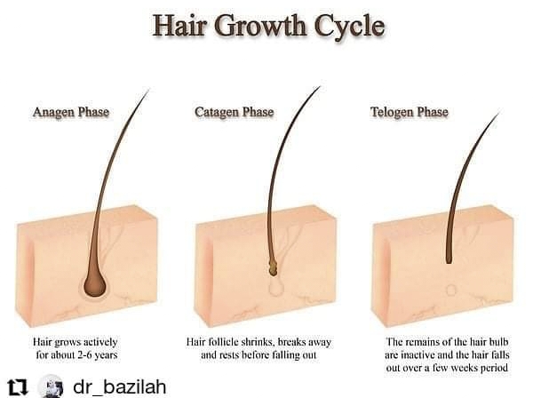 Rawatan 'Hair Removal Laser' Klinik Dr Bazilah Atasi Masalah Bulu Berlebihan Wanita. Selamat dan Tidak Menyakitkan
