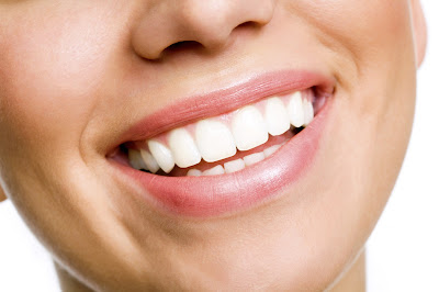 natural teeth whitening