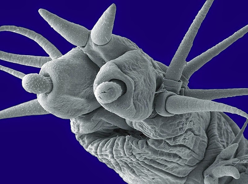 16 Terryfying Images From The Microscope - Marine worm