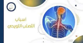 أسباب مرض التصلب اللويحي