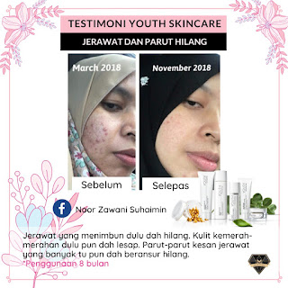 Harga YOUTH Shaklee, Review Pengguna Youth Skincare, Skincare, YOUTH Skincare Shaklee, qiya beauty, qiya saad, pengedar shaklee klang, shaklee bandar putera 2 klang, shaklee shah alam, set penjagaan kulit, cara hilangkan jerawat pasir jerawat batu, pudarkan parut, pencuci muka organik, toner wajah, pelembab wajah, krim pelindung matahari, SPF, sun protection, masalah kulit wajah, licinkan kulit, putihkan kulit muka, rawatan muka, facial cleanser, pencuci muka, serum untuk kulit cantik, tona kulit tak sekata, pigmentasi, kesan hormon tak seimbang, testimoni youth skincare shaklee, polifenol untuk kulit wajah cantik awet muda,