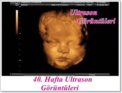 40.Hafta Ultrason Görüntüleri