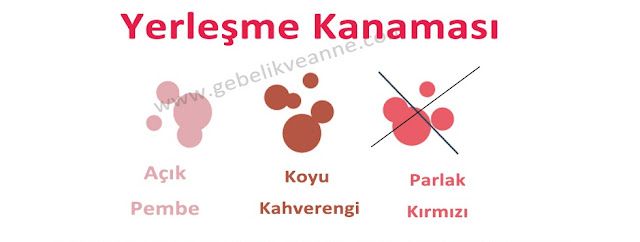 Yerleşme Kanaması