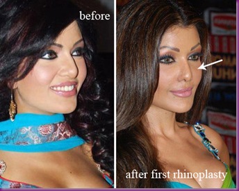koena_mitra_before_and_after_nose_job
