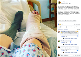 Jamie Allison Sanders, ankle break, broken ankle, Beautifying the Broken Ankle, 